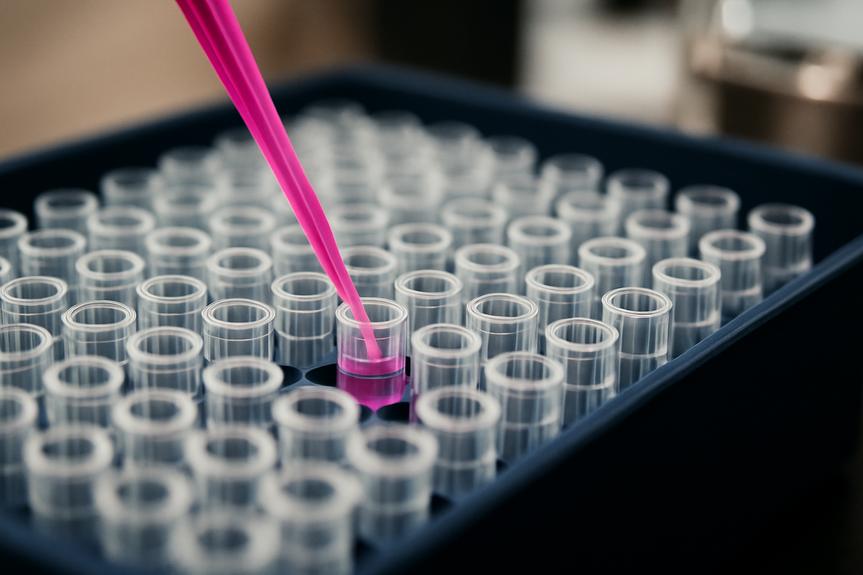 Comment un joueur chanceux a dérivé de la loterie à l&rsquo;improviste!